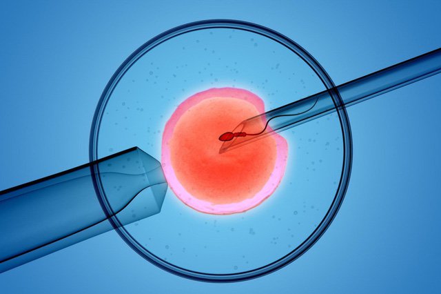 Thụ tinh ống nghiệm IVF các bước thực hiện như thế nào?