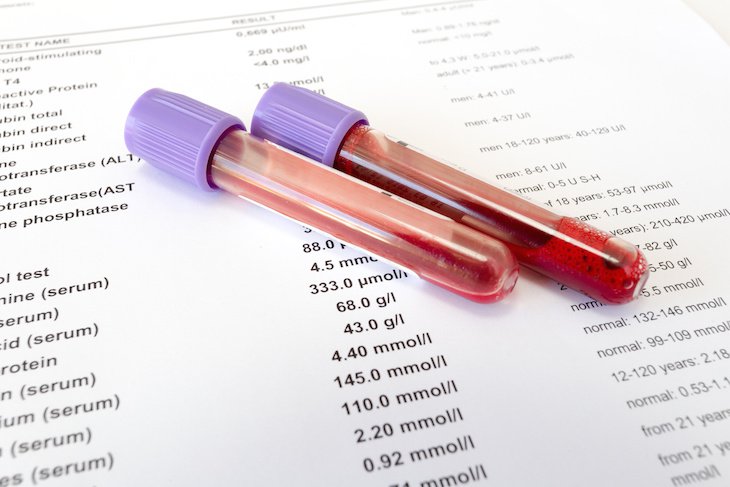 Ý nghĩa các xét nghiệm chẩn đoán bệnh viêm gan B - ảnh 1