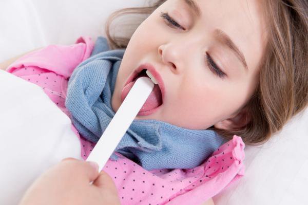 Viêm họng liên cầu khuẩn ở trẻ em là bệnh gì? Chẩn đoán, điều trị và Cách phòng ngừa - ảnh 1