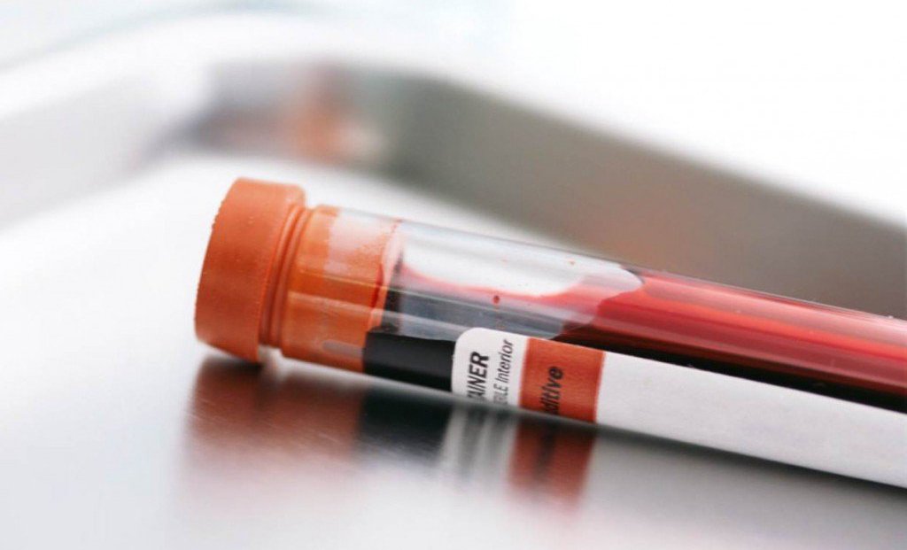 Các xét nghiệm máu đánh giá tình trạng gan - ảnh 1
