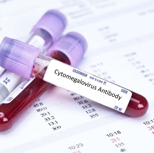 Xét nghiệm CMV Chẩn đoán nhiễm virus cytomegalo