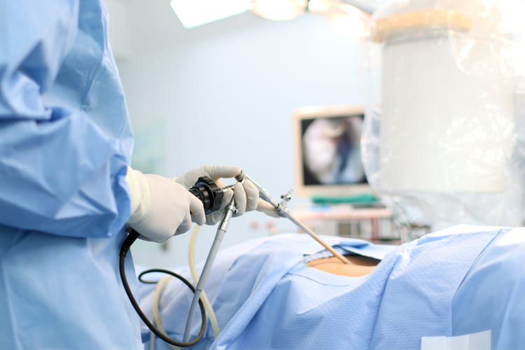 Phẫu thuật nội soi cắt tử cung hoàn toàn: Những điều cần biết
