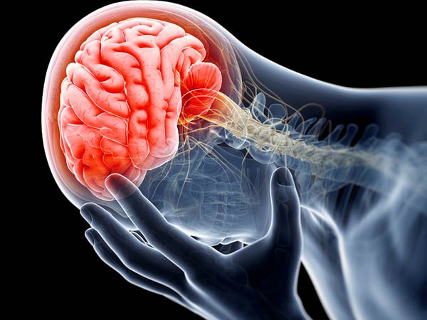 Vai trò của chụp cộng hưởng từ trong chấn thương sọ não