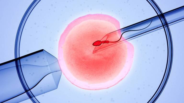 Tiêm tinh trùng vào bào tương của noãn (ICSI): Giải pháp cho các cặp vợ chồng vô sinh