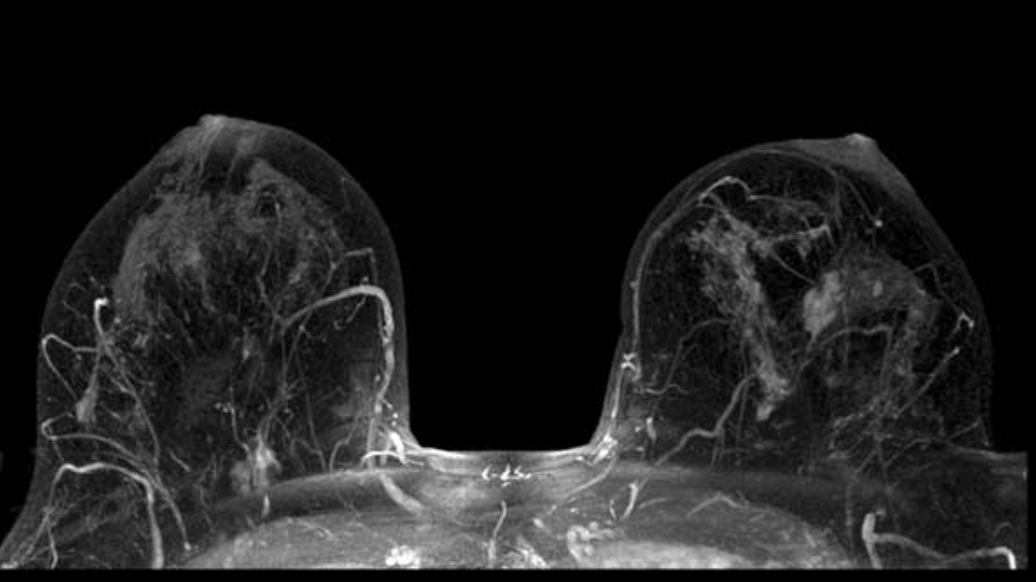 Ứng dụng của MRI trong tim mạch, não, tủy sống, xương, nội tạng - ảnh 3
