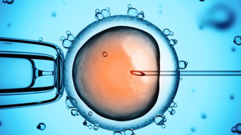 Cách thức làm giảm đa thai trong thụ tinh ống nghiệm (IVF) - ảnh 2