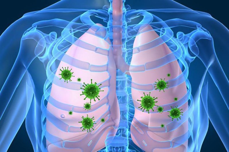 Những điều cần biết về bệnh viêm phổi hít - ảnh 1