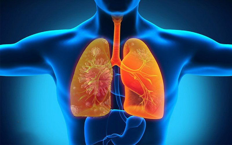 Những điều cần biết về bệnh viêm phổi hít