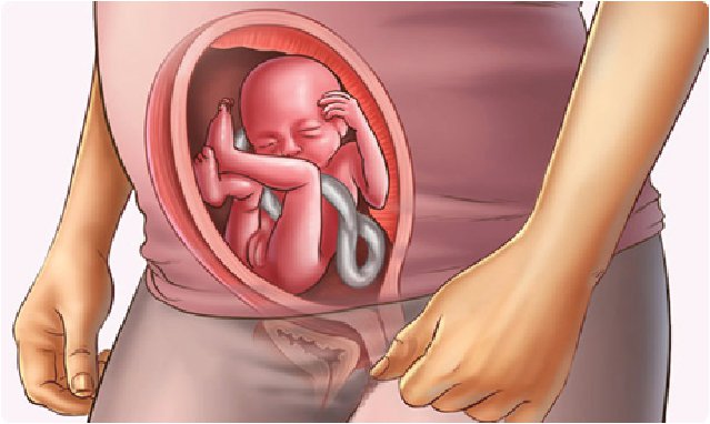 Chụp cộng hưởng từ thai nhi - ảnh 2