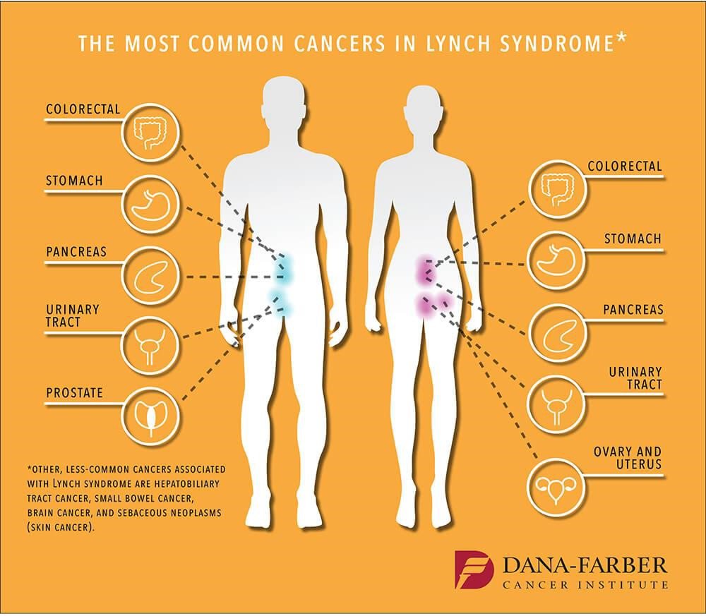Hội chứng Lynch: Nguyên nhân và chẩn đoán - ảnh 1