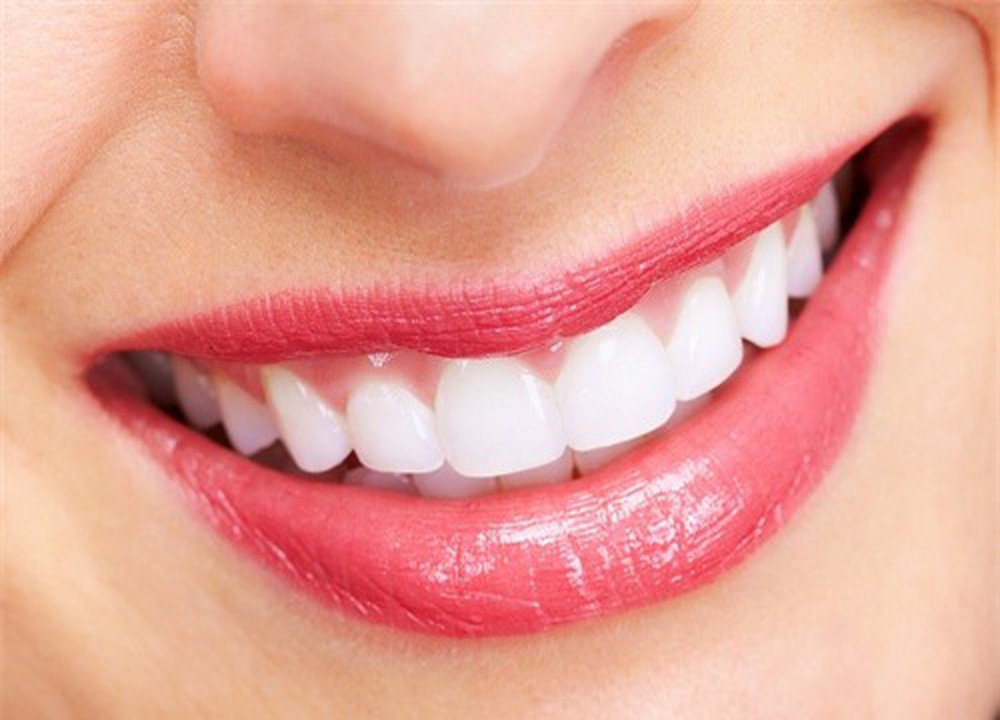 Răng sâu nên bọc răng sứ hay trám răng? - ảnh 1