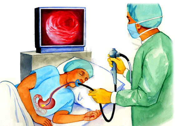Phẫu thuật cắt polyp dạ dày và những điều bệnh nhân cần lưu ý - ảnh 2