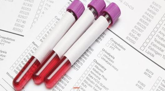 Viêm gan B là bệnh gì? Xét nghiệm máu chẩn đoán Viêm gan B - ảnh 3