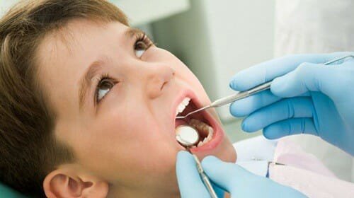 Xiết ăn răng ở trẻ em là gì? Điều trị và Cách phòng ngừa - ảnh 2