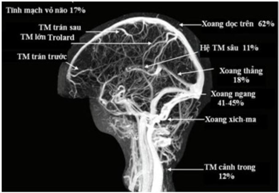 Quy trình chụp cộng hưởng từ hệ mạch máu nội sọ không tiêm đối quang từ - ảnh 1