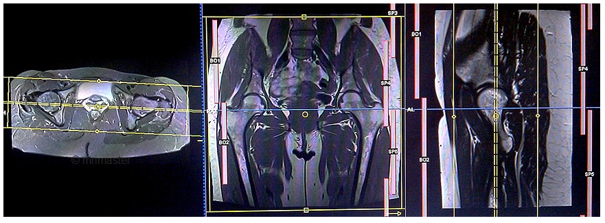 Quy trình chụp cộng hưởng từ khớp không tiêm thuốc đối quang từ - ảnh 2