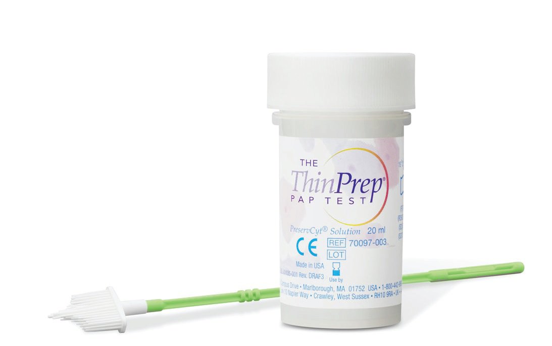Sàng lọc ung thư cổ tử cung bằng phương pháp Thinprep - ảnh 2