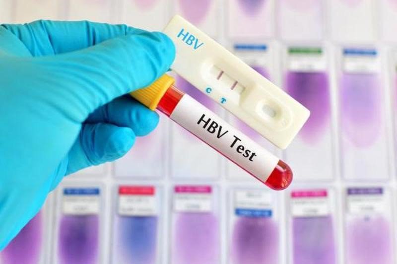 Phân biệt Xét nghiệm viêm gan B và Xét nghiệm HIV - ảnh 1