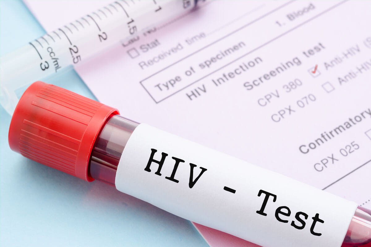 Phân biệt Xét nghiệm viêm gan B và Xét nghiệm HIV - ảnh 3