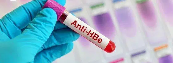 Phân biệt Xét nghiệm viêm gan B và Xét nghiệm HIV - ảnh 2