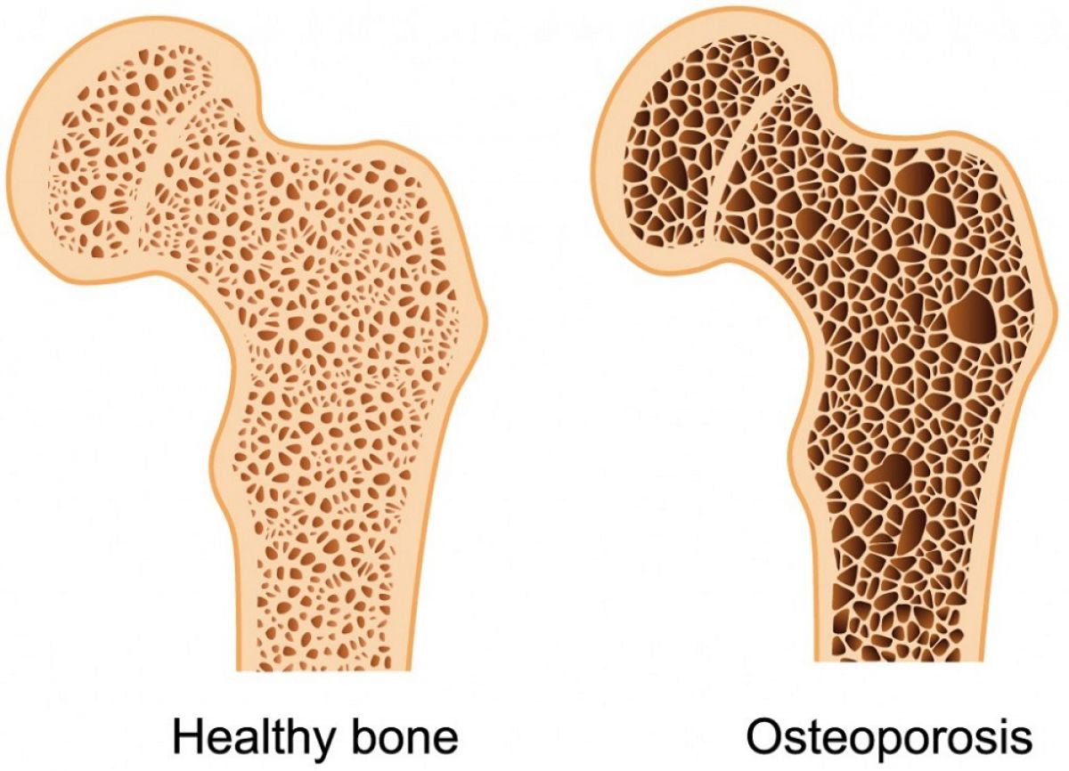 Quy trình chụp cắt lớp vi tính xương chi có tiêm thuốc cản quang - ảnh 3