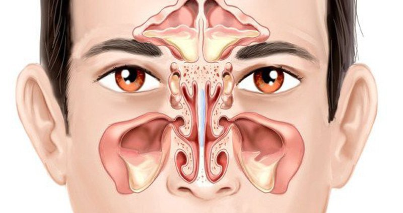 Phẫu thuật nội soi mũi xoang: Đối tượng, quy trình và theo dõi sau phẫu thuật 