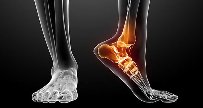 Chụp X-quang khớp cổ chân thẳng nghiêng là gì? Chuẩn bị và Quy trình chụp