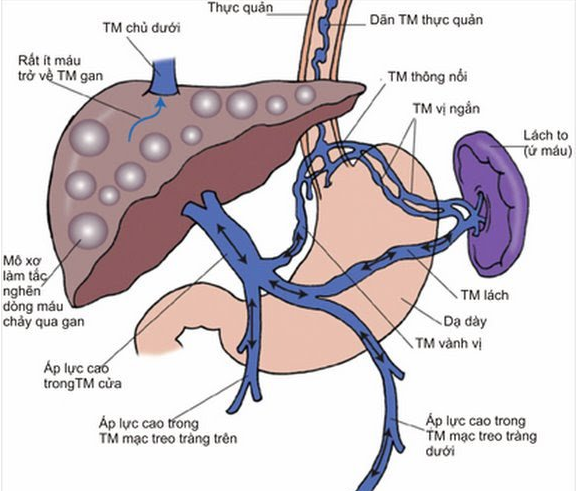 Quy trình chụp số hóa nền và can thiệp tĩnh mạch lách - cửa - ảnh 1