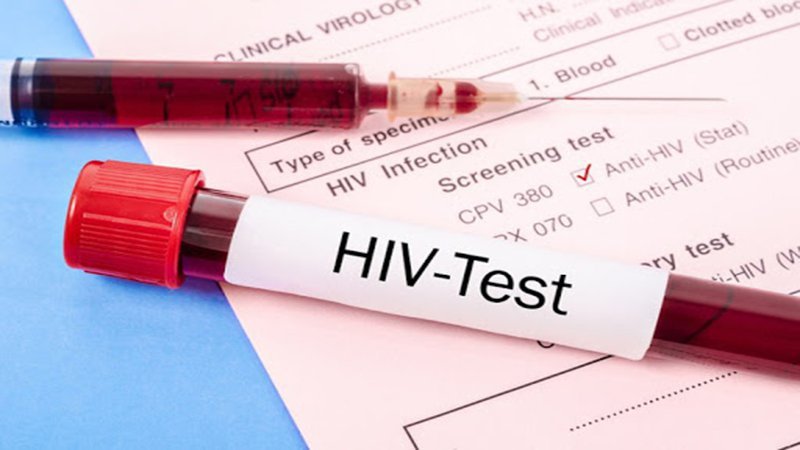 Phát ban HIV: Nguyên nhân, triệu chứng và cách xử lý bệnh - ảnh 2