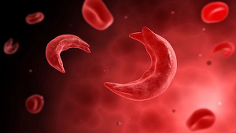 Ghép tế bào gốc tạo máu ở trẻ em - ảnh 1