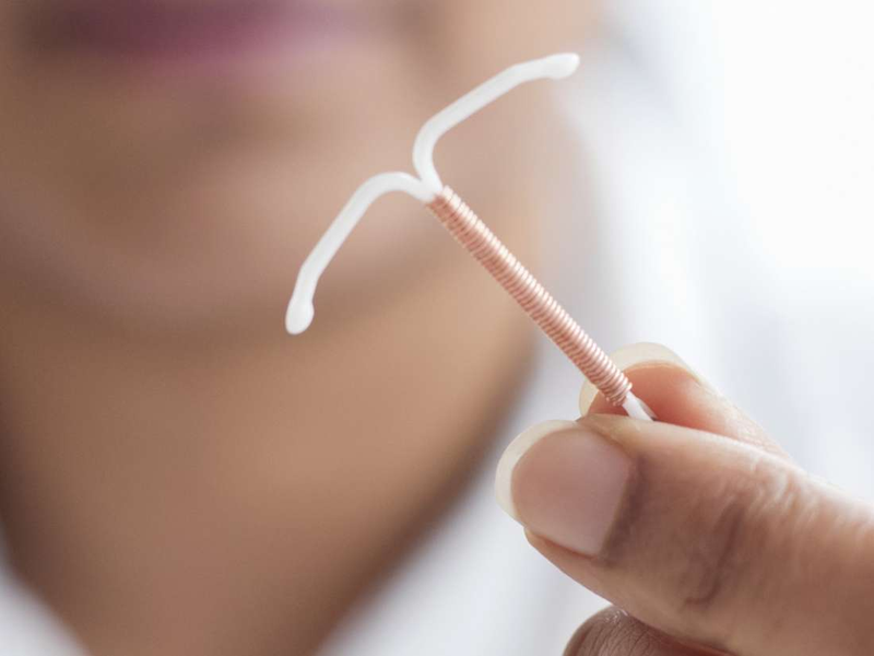 Đặt và tháo dụng cụ tử cung tránh thai - ảnh 1