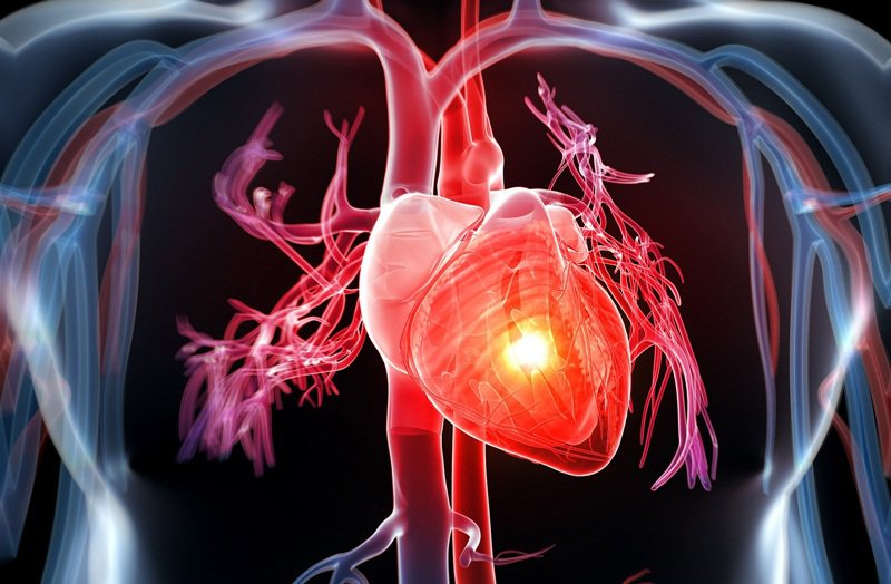 Thông tim ống lớn và chụp buồng tim cản quang - ảnh 1