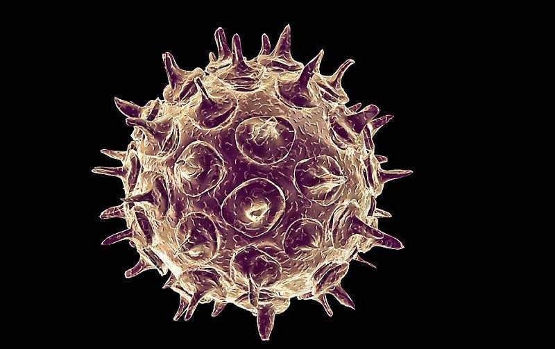 Tiêm vắc xin ngừa varicella-zoster virus khi bạn bị nhiễm HIV - ảnh 1