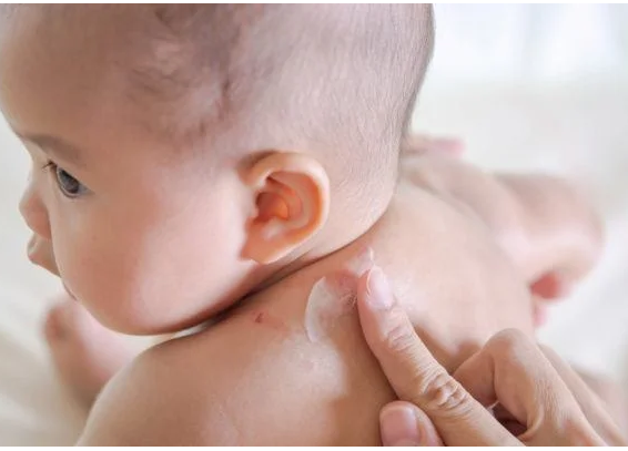 Có nên dùng kem dưỡng ẩm cho trẻ sơ sinh?