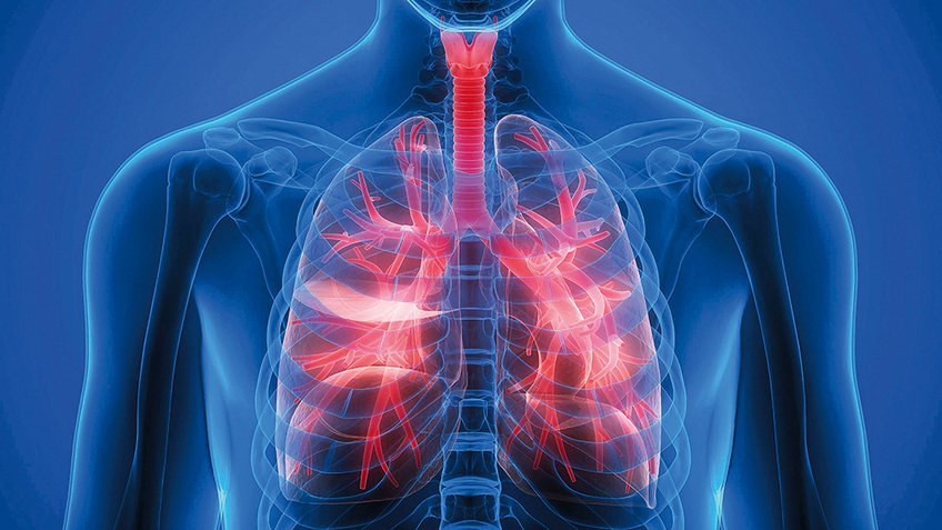 Nên chụp cộng hưởng từ thông khí phổi để chẩn đoán bệnh phổi tắc nghẽn mãn tính - ảnh 1