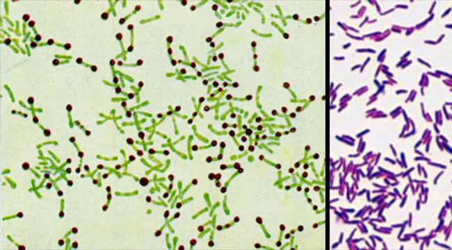 Vi khuẩn bạch hầu sống được ở nhiệt độ nào?