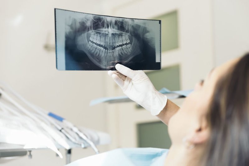 Quy trình chụp X quang răng được thực hiện như thế nào?