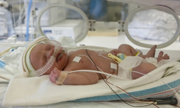 Cơn ngừng thở ở trẻ sinh non: Những điều cần biết - ảnh 3