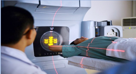 Xạ trị công nghệ cao - kỹ thuật xạ phẫu định vị thân (SBRT)