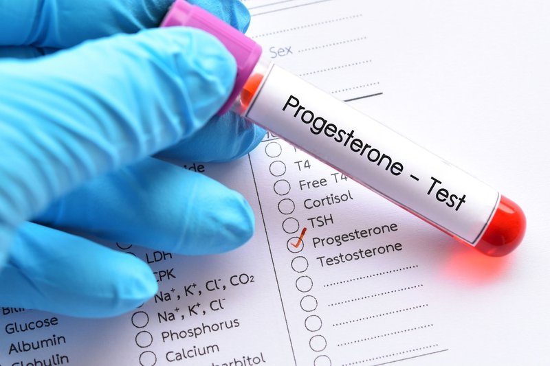 Xét nghiệm Progesterone đánh giá sự phóng noãn của buồng trứng