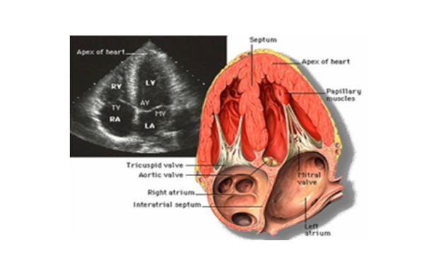 Siêu âm tim kiểu TM và những điều cần biết - ảnh 1