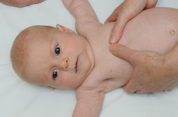 Phát hiện sớm lõm ngực bẩm sinh ở trẻ