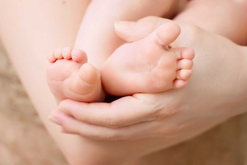 Chẩn đoán và điều trị dị tật bàn chân khoèo ở trẻ sơ sinh